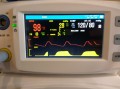 Kapnograf Monitor Pacjenta YK810B.jpg
