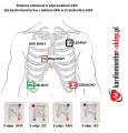 Miejsce założenia odprowadzeń EKG.png